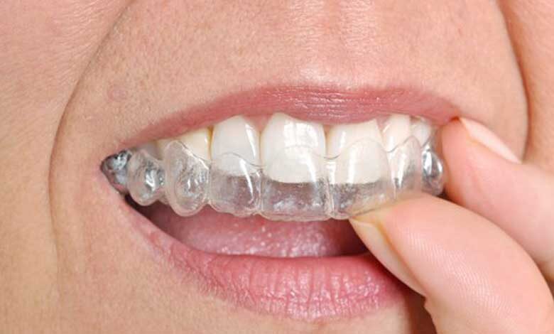 Ortodontik Tedavi Çeşitleri
